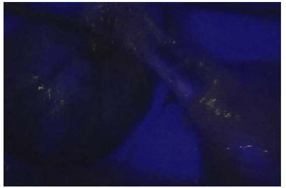 Laparoscopic video augmentation with infrared image information