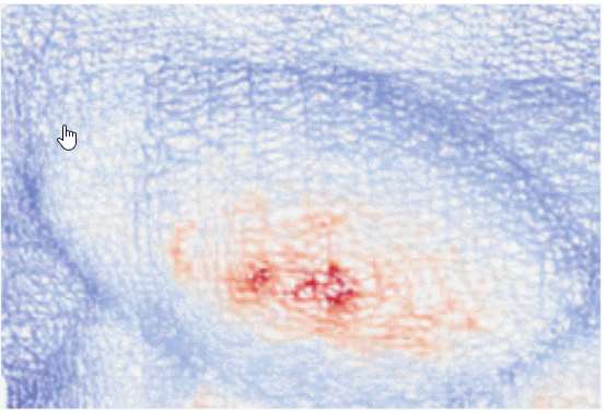 Surface Reconstruction from Endoscopic Image Sequence