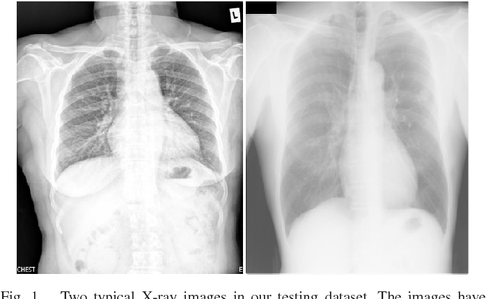 X-Ray Enhancement Based on Component Attenuation, Contrast Adjustment, and Image Fusion